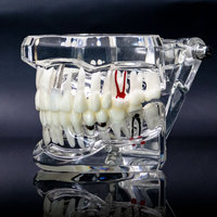 1 szt. Model dentystyczny Zęby Implant Przywrócenie mostu Badanie dydaktyczne Ząb Nauki medyczne Choroby dentysty Produkty stomatologiczne 3